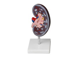 Модель почки в разрезе - fgospostavki.ru - Самара